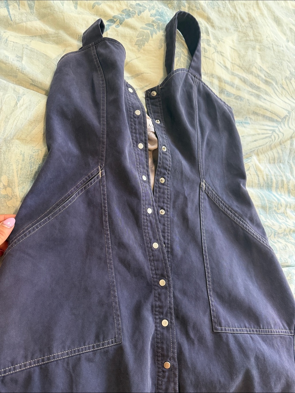 Custom A.L.C Button Dress - Picture 2 of 3